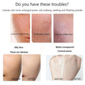 Before and after makeup finish comparison using CandyBella Oil Control Compact Powder showing smoother matte-looking skin