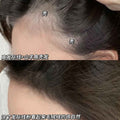Close-up of a person's head with text indicating hairline and baldness issues.